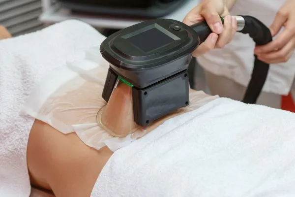 Image of person having fat freezing treatment to help weight gain Hatfield