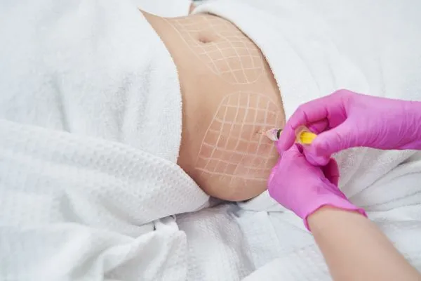 image of fat dissolving injections on love handles to help combat weight gain Hatfield
