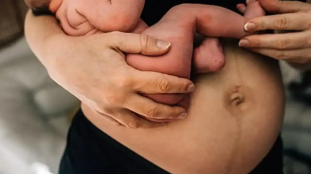 Why Is My Stomach Still Big After Pregnancy Hatfield?